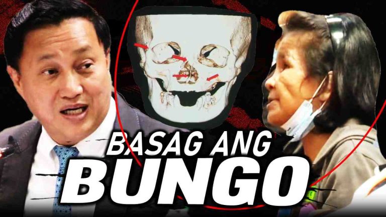 Basag ang bungo ni Manang Elvie sa kalupitan si France Ruiz