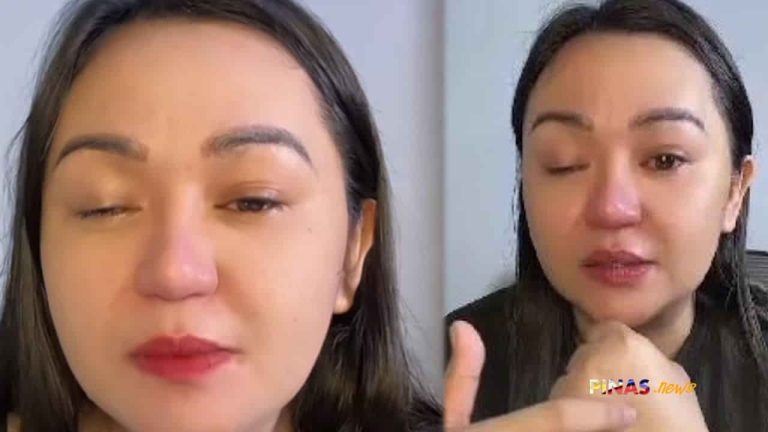 Delikadong resulta ng gluta drip: Babae pumutok ang ugat sa mata